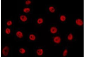 Image no. 1 for anti-Protein Inhibitor of Activated STAT, 3 (PIAS3) antibody (ABIN6264198)