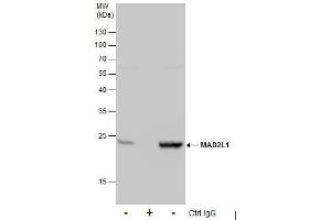 Image no. 3 for anti-MAD2 Mitotic Arrest Deficient-Like 1 (Yeast) (MAD2L1) (C-Term) antibody (ABIN2855897)
