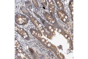 Image no. 1 for anti-Mitochondrial Ribosomal Protein L37 (MRPL37) antibody (ABIN5583743)