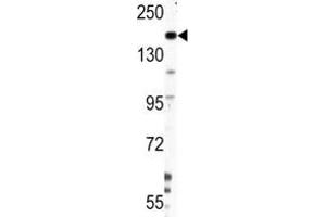Image no. 7 for anti-Nestin (NES) (AA 1389-1416) antibody (ABIN3031961)