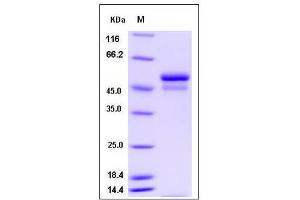 Image no. 1 for serpin Peptidase Inhibitor, Clade I (neuroserpin), Member 1 (SERPINI1) (AA 1-410) protein (His tag) (ABIN2008417)