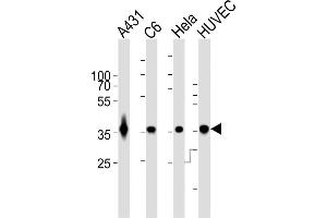 Image no. 6 for anti-Glyceraldehyde-3-Phosphate Dehydrogenase (GAPDH) antibody (ABIN1539789)