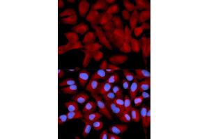 Image no. 3 for anti-Eukaryotic Translation Initiation Factor 5A (EIF5A) antibody (ABIN3015836)