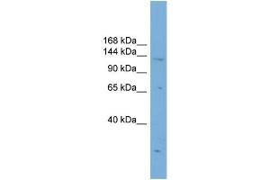 Image no. 1 for anti-PR Domain Containing 16 (PRDM16) (Middle Region) antibody (ABIN2777828)