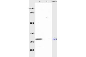 Image no. 4 for anti-Aquaporin 1 (Colton Blood Group) (AQP1) (AA 181-269) antibody (ABIN687502)