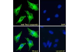 Image no. 5 for anti-Thrombospondin 1 (THBS1) (N-Term) antibody (ABIN1781811)