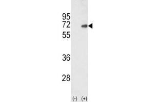 Image no. 4 for anti-SMAD Family Member 4 (SMAD4) (AA 400-428) antibody (ABIN3032608)
