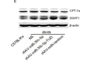 Image no. 6 for anti-Carnitine Palmitoyltransferase 1A (Liver) (CPT1A) antibody (ABIN6138976)