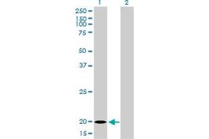 Image no. 5 for anti-Ferritin, Light Polypeptide (FTL) (AA 1-175) antibody (ABIN947883)