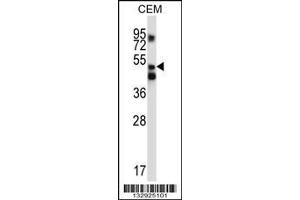 Image no. 1 for anti-X-Prolyl Aminopeptidase (Aminopeptidase P) 3, Putative (XPNPEP3) (AA 440-469), (C-Term) antibody (ABIN657127)