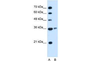 Image no. 2 for anti-Arginase, Liver (ARG1) (C-Term) antibody (ABIN2782310)
