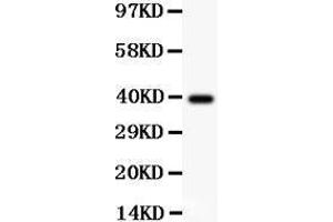 Image no. 3 for anti-Sirtuin 2 (SIRT2) (AA 165-187), (Middle Region) antibody (ABIN3043924)