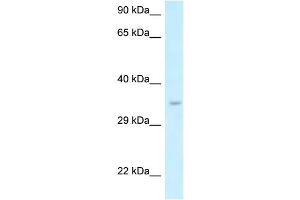 anti-SIX Homeobox 1 (SIX1) (N-Term) antibody