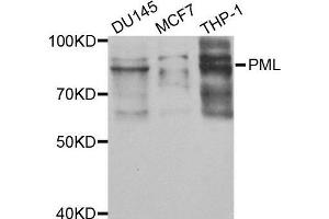Image no. 2 for anti-Promyelocytic Leukemia (PML) antibody (ABIN3021659)