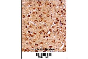 Image no. 1 for anti-Mitogen-Activated Protein Kinase Kinase 7 (MAP2K7) (AA 206-233) antibody (ABIN5534517)