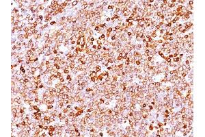 Image no. 3 for anti-B-cell antigen receptor complex-associated protein alpha chain (CD79A) (AA 202-216) antibody (ABIN6941266)
