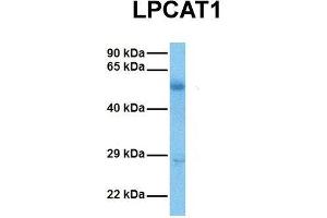 Image no. 2 for anti-Lysophosphatidylcholine Acyltransferase 1 (LPCAT1) (Middle Region) antibody (ABIN2783952)