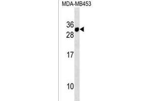 CD300E Antibody (Center) (ABIN1538447 and ABIN2838202) western blot analysis in MDA-M cell line lysates (35 μg/lane).