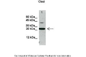 Image no. 3 for anti-Cathepsin D (CTSD) (C-Term) antibody (ABIN2776841)