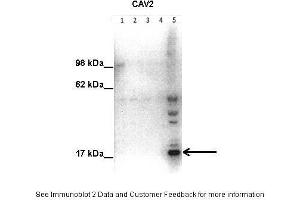 Image no. 3 for anti-Caveolin 2 (CAV2) (N-Term) antibody (ABIN2792220)
