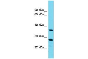 Image no. 1 for anti-Protein Tyrosine Phosphatase, Non-Receptor Type 20A (PTPN20A) (Middle Region) antibody (ABIN2791465)