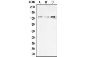 Image no. 3 for anti-Endoplasmic Reticulum Aminopeptidase 1 (ERAP1) (Center) antibody (ABIN2706120)