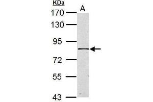 Image no. 2 for anti-Hydroxysteroid (17-Beta) Dehydrogenase 4 (HSD17B4) (Center) antibody (ABIN2855717)