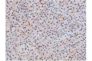 Image no. 4 for anti-Signal Transducer and Activator of Transcription 3 (Acute-Phase Response Factor) (STAT3) (pSer727) antibody (ABIN6256411)