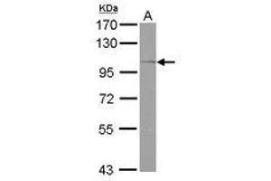 Image no. 2 for anti-Oxysterol Binding Protein-Like 5 (OSBPL5) (Internal Region) antibody (ABIN1496100)