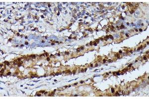 Immunohistochemistry of paraffin-embedded Rat lung using GADD45A Polyclonal Antibody at dilution of 1:100 (40x lens).