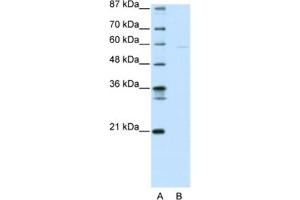 Image no. 1 for anti-SWI/SNF Related, Matrix Associated, Actin Dependent Regulator of Chromatin, Subfamily D, Member 3 (SMARCD3) antibody (ABIN2461185)