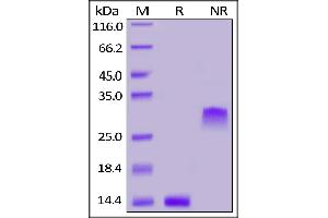 Image no. 2 for Platelet-Derived Growth Factor beta Polypeptide (PDGFB) (AA 82-190) (Active) protein (ABIN6731333)
