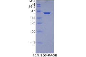 Image no. 1 for Histone Cluster 2, H2aa3 (HIST2H2AA3) protein (ABIN3009879)