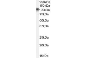 CRTAM antibody  (C-Term)