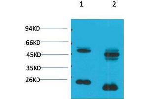 anti-Potassium Voltage-Gated Channel, Shaker-Related Subfamily, Member 10 (KCNA10) antibody
