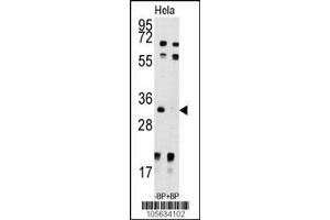 Image no. 1 for anti-Uridine-Cytidine Kinase 2 (UCK2) (AA 1-30), (N-Term) antibody (ABIN391286)