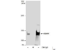 Image no. 4 for anti-Adenosine Deaminase, RNA-Specific (ADAR) (Internal Region) antibody (ABIN2855100)