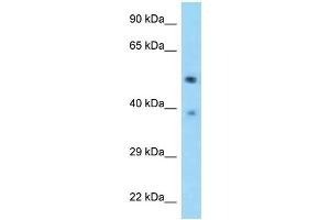 Image no. 1 for anti-tRNA-splicing Endonuclease Subunit SEN2 (TSEN2) (C-Term) antibody (ABIN2789135)