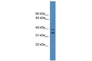 Image no. 1 for anti-Ubiquitin Fusion Degradation Protein 1 Homolog (UFD1L) (Middle Region) antibody (ABIN2788062)