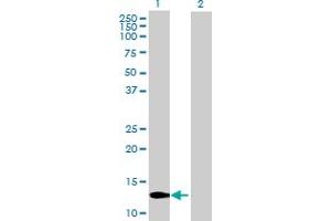 Western Blot analysis of PDRG1 expression in transfected 293T cell line by PDRG1 MaxPab polyclonal antibody.