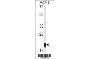 anti-Mitochondrial Ribosomal Protein S25 (MRPS25) (AA 145-173), (C-Term) antibody