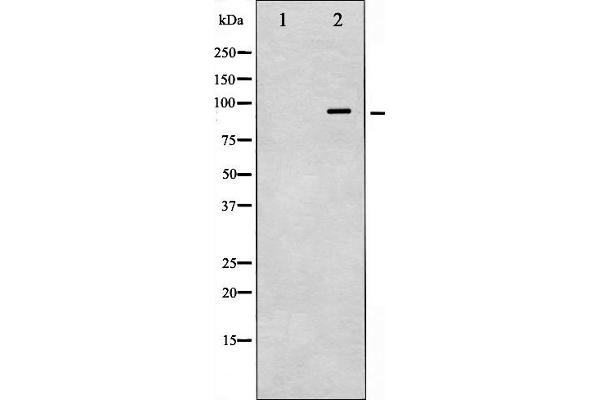 anti-Vav 1 Oncogene (VAV1) (pTyr174) antibody