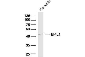 Image no. 1 for anti-BPI Fold Containing Family B, Member 2 (BPIFB2) antibody (ABIN1388021)