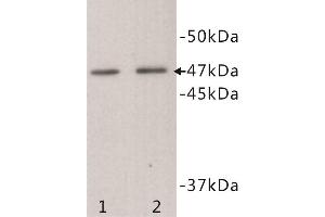 Image no. 1 for anti-Transmembrane Protein 200A (TMEM200A) antibody (ABIN1854992)