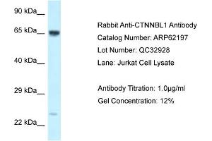 Image no. 1 for anti-Catenin, beta Like 1 (CTNNBL1) (C-Term) antibody (ABIN2789059)
