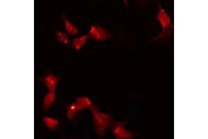 Image no. 2 for anti-HORMA Domain Containing 1 (HORMAD1) (C-Term) antibody (ABIN6262338)