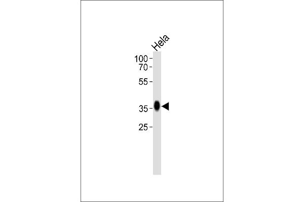 anti-Folate Receptor 1 (Adult) (FOLR1) (AA 33-68), (N-Term) antibody