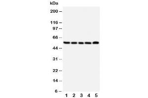 Image no. 2 for anti-Tachykinin Receptor 1 (TACR1) (Middle Region) antibody (ABIN3029090)