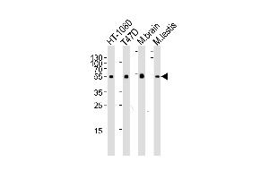 Image no. 2 for anti-Tubulin, alpha 1c (TUBA1C) (AA 26-60), (N-Term) antibody (ABIN5533008)