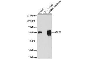 Image no. 7 for anti-Arrestin, beta 1 (ARRB1) antibody (ABIN3021265)
